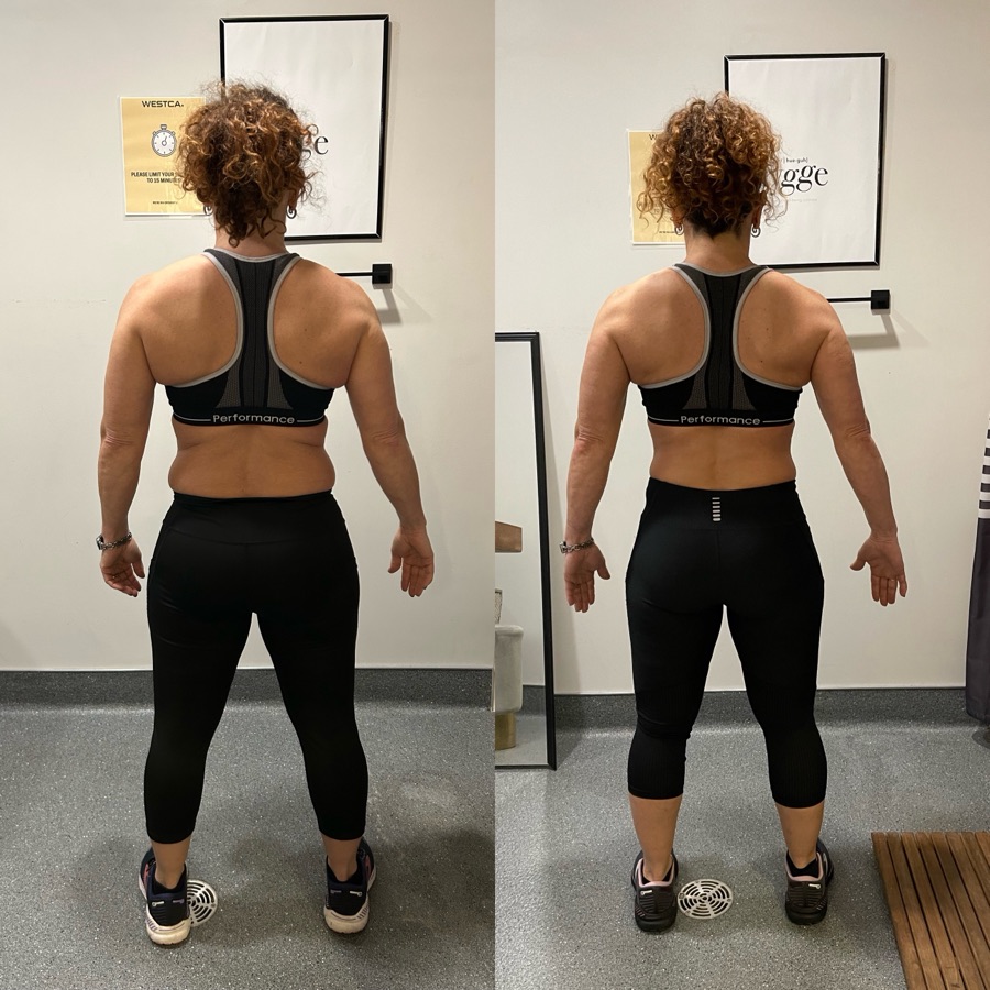 Melani — before and after transformation